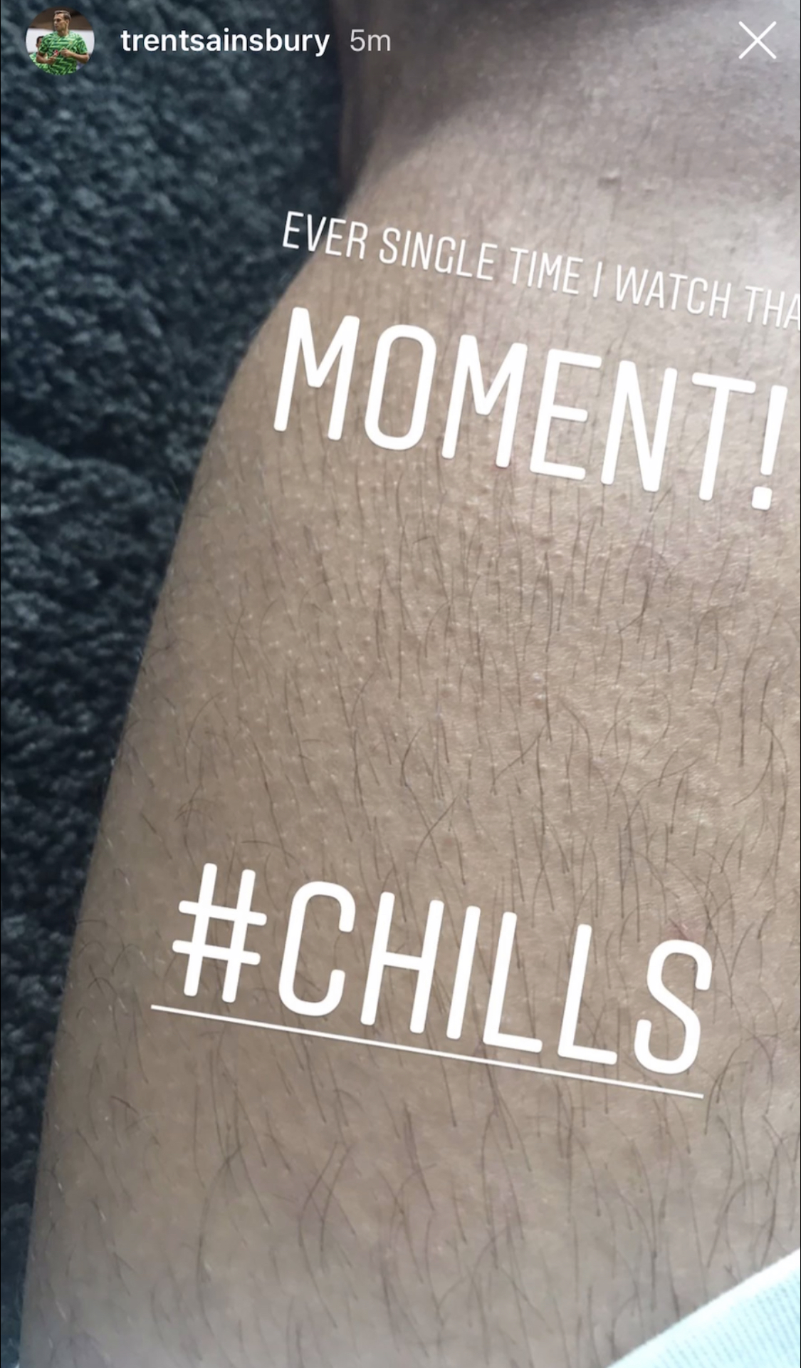 Sainsbury leg Sainsbury leg